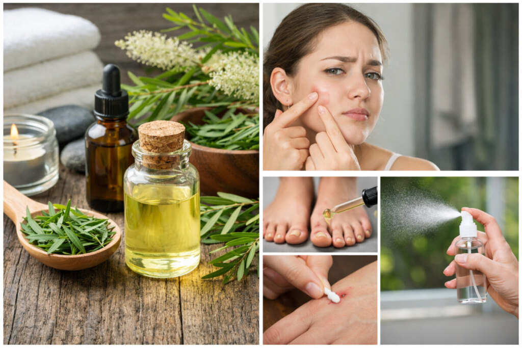 Melaleuca alternifolia: para que serve esta planta medicinal? em Plantas medicinais Melaleuca alternifolia: para que serve esta planta medicinal?